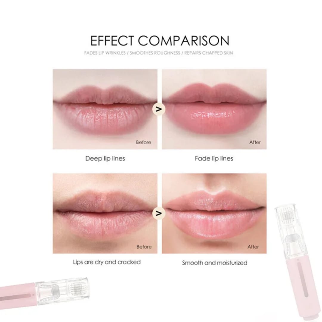 Juicy Lips Lip Boosting System